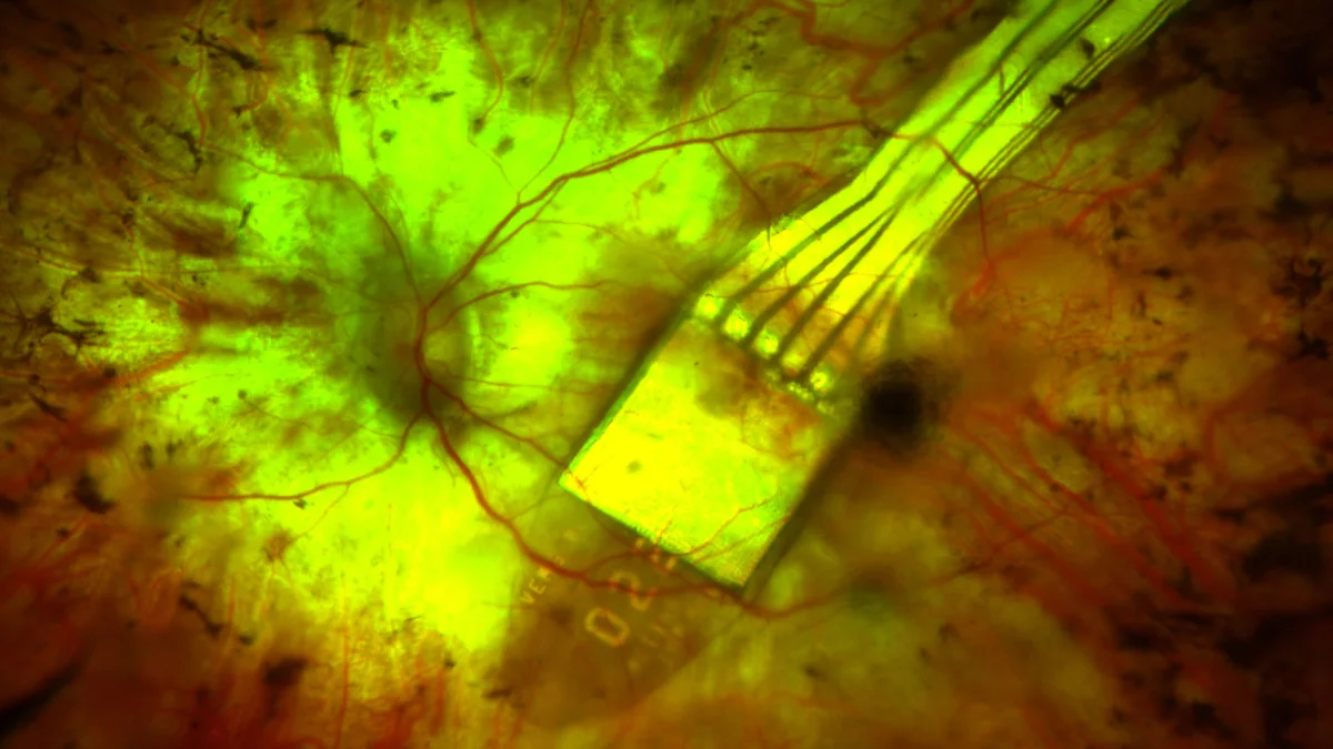 Science Corporation'ın retina çipi ilk Stargardt hastasına harf okuttu