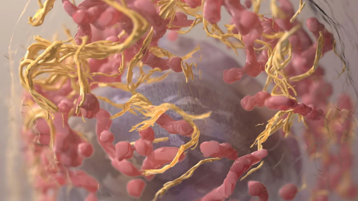 Moderna ve Merck'in kanser aşısı melanomayı 42% azaltıyor